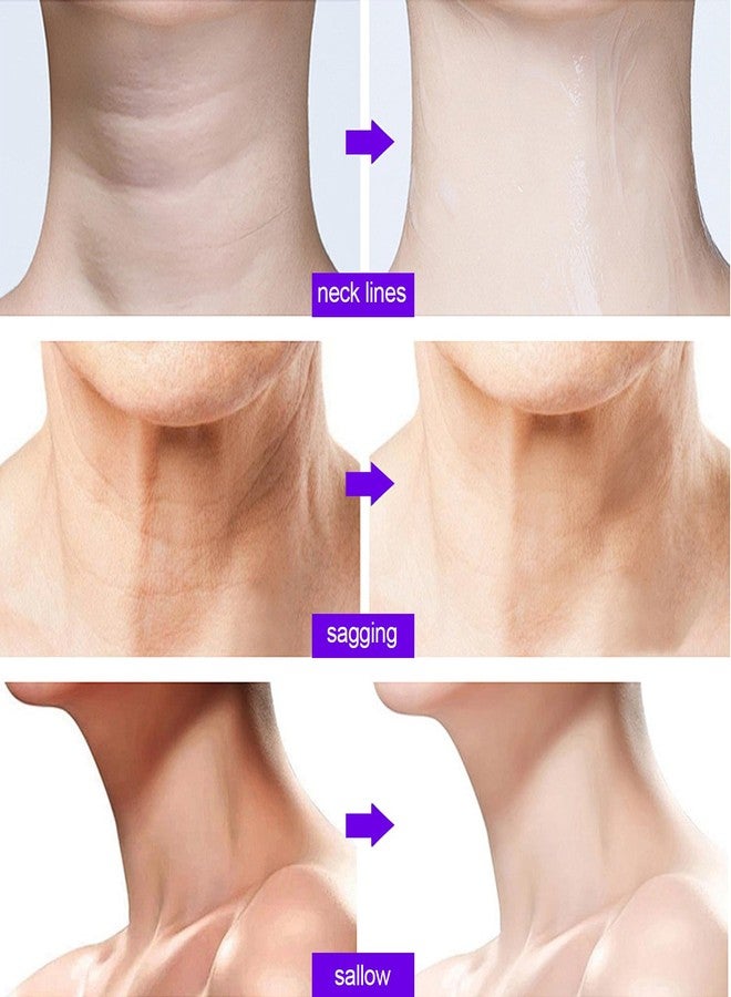 YURHERSU كريم يورهيرسو لشد الرقبة، يحفز الكولاجين لشد وترطيب بشرة الرقبة، ويعزز مرونة البشرة، مغذي وسريع الامتصاص، مضاد للتجاعيد للعناية اليومية بالرقبة (50 غ/1.76 أونصة) - Image 5
